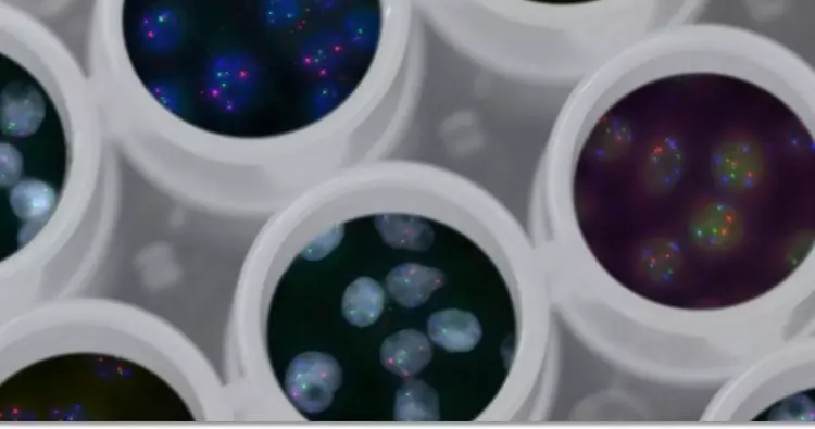 The Hope Foundation For Cancer Research