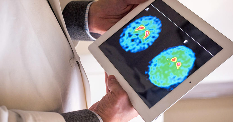 The Michael J Fox Foundation